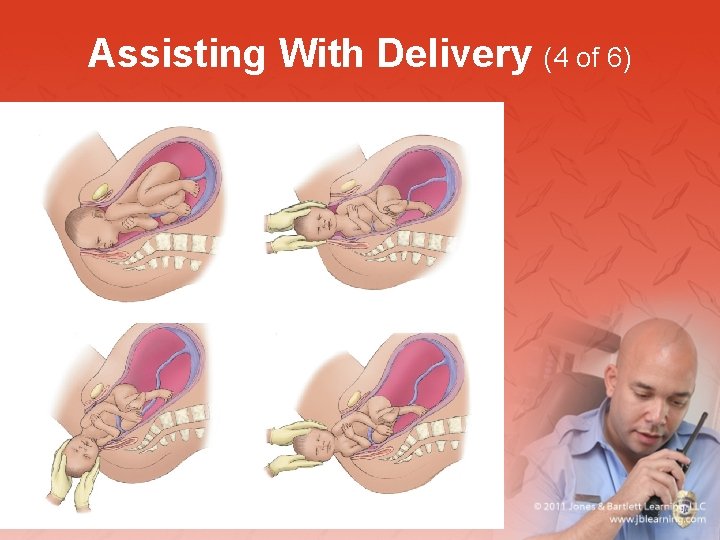 Assisting With Delivery (4 of 6) 