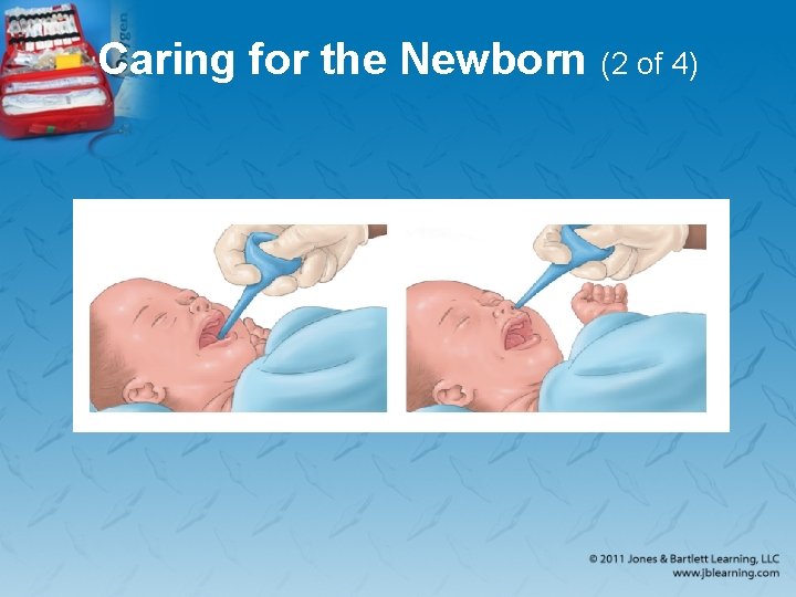 Caring for the Newborn (2 of 4) 