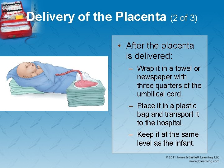 Delivery of the Placenta (2 of 3) • After the placenta is delivered: –