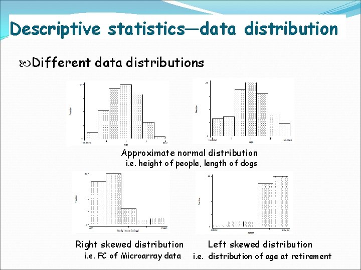 Descriptive statistics—data distribution Different data distributions Approximate normal distribution i. e. height of people,