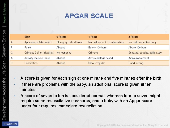APGAR SCALE • • • A score is given for each sign at one