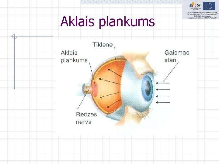 Aklais plankums Aklais plankums