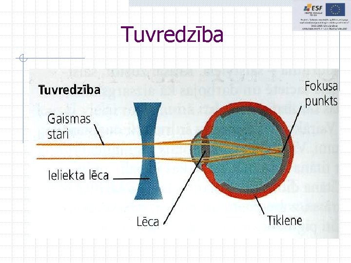 Tuvredzība Tuvredzība