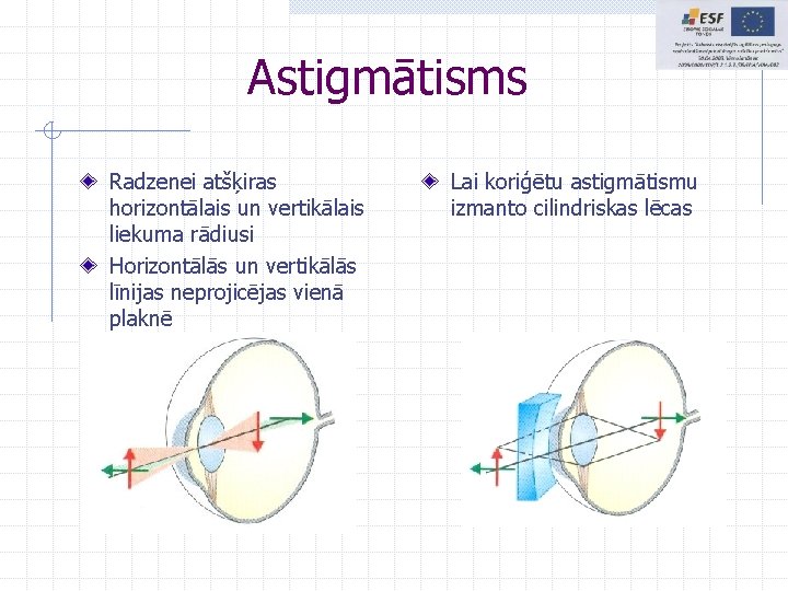 Astigmātisms Radzenei atšķiras horizontālais un vertikālais liekuma rādiusi Horizontālās un vertikālās līnijas neprojicējas vienā Astigmātisms Radzenei atšķiras horizontālais un vertikālais liekuma rādiusi Horizontālās un vertikālās līnijas neprojicējas vienā