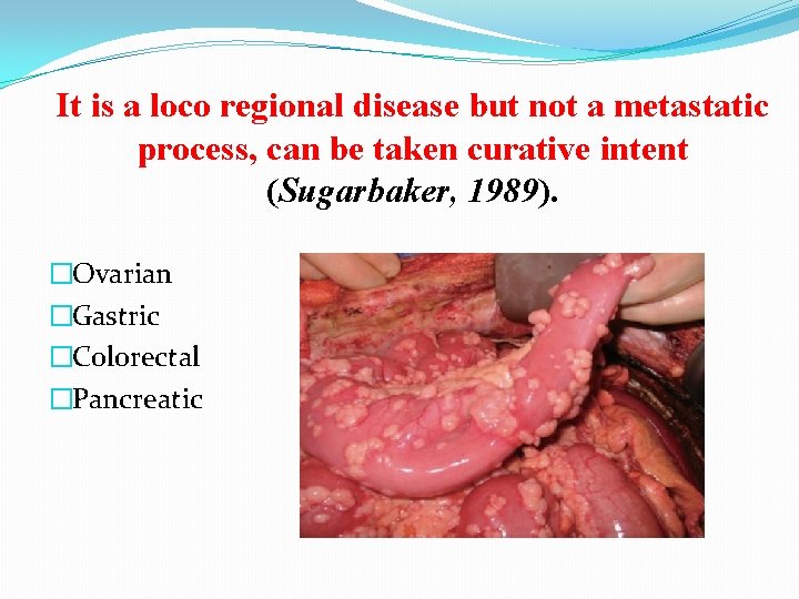 It is a loco regional disease but not a metastatic process, can be taken