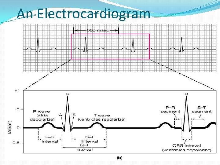 An Electrocardiogram 