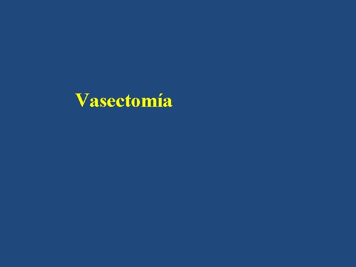 Vasectomía 