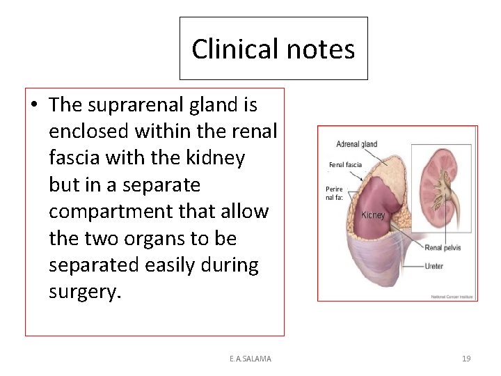 Clinical notes • The suprarenal gland is enclosed within the renal fascia with the