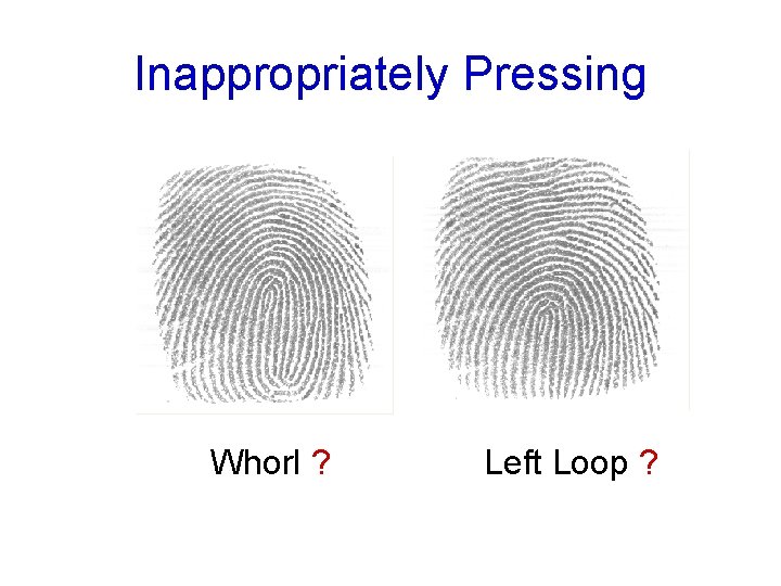 Inappropriately Pressing Whorl ? Left Loop ? 