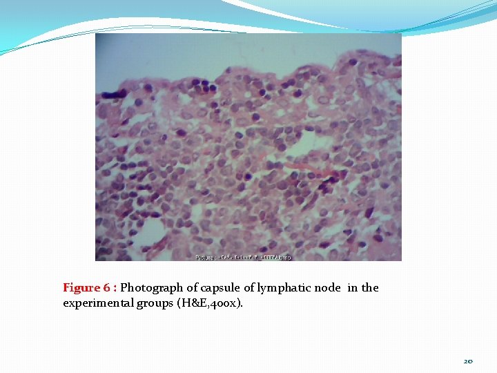 Figure 6 : Photograph of capsule of lymphatic node in the experimental groups (H&E,