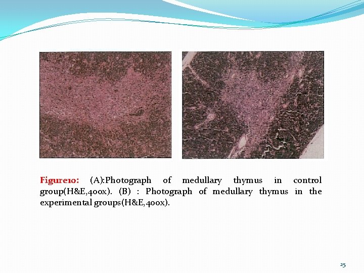 Figure 10: (A): Photograph of medullary thymus in control group(H&E, 400 x). (B) :