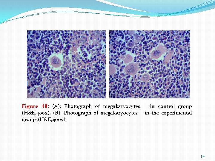 Figure 19: (A): Photograph of megakaryocytes in control group (H&E, 400 x). (B): Photograph