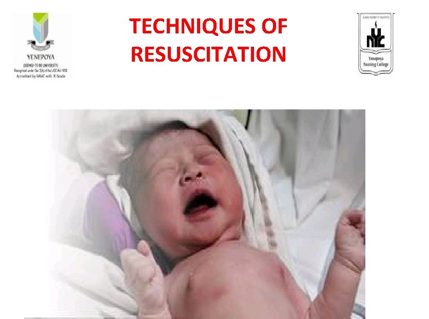 TECHNIQUES OF RESUSCITATION 