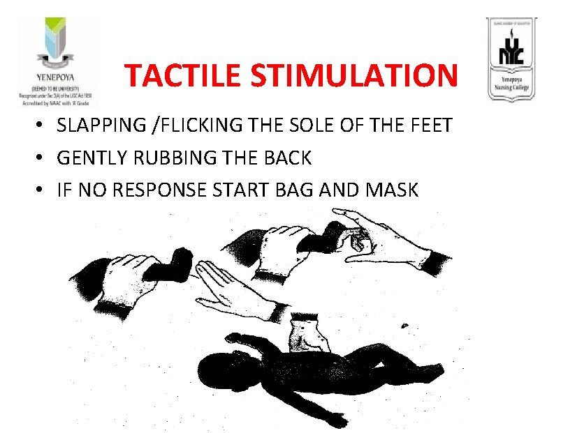 TACTILE STIMULATION • SLAPPING /FLICKING THE SOLE OF THE FEET • GENTLY RUBBING THE
