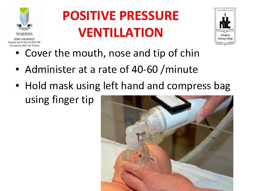 POSITIVE PRESSURE VENTILLATION • Cover the mouth, nose and tip of chin • Administer