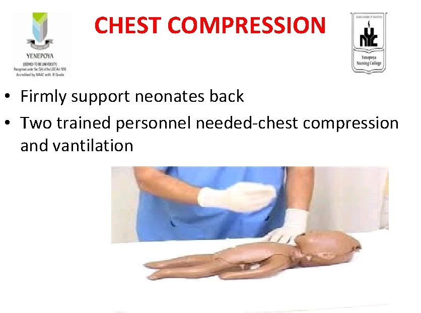 CHEST COMPRESSION • Firmly support neonates back • Two trained personnel needed-chest compression and