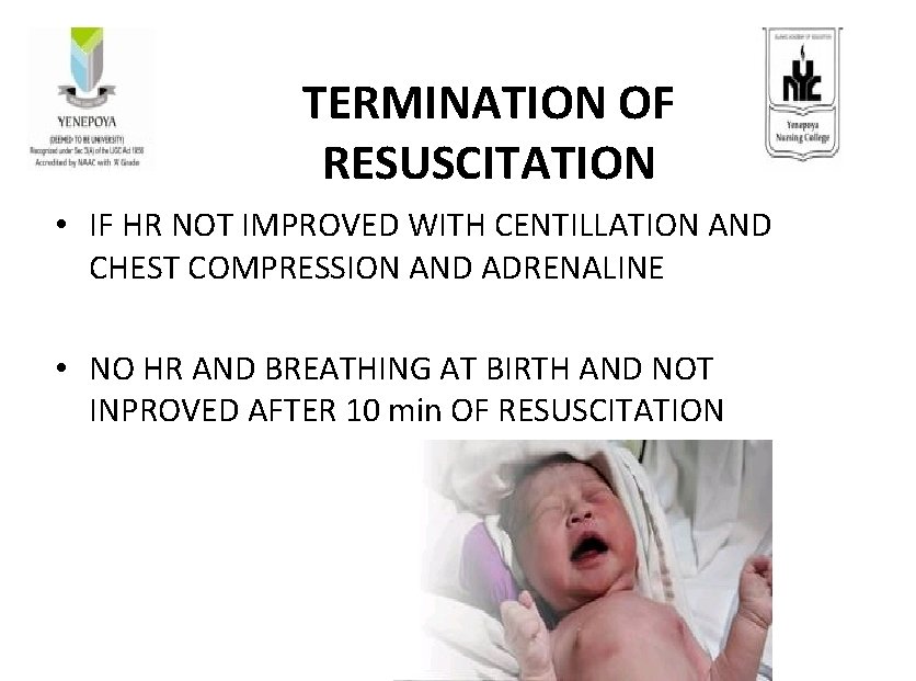 TERMINATION OF RESUSCITATION • IF HR NOT IMPROVED WITH CENTILLATION AND CHEST COMPRESSION AND