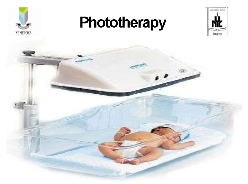 Phototherapy Care for the infant under phototherapy 