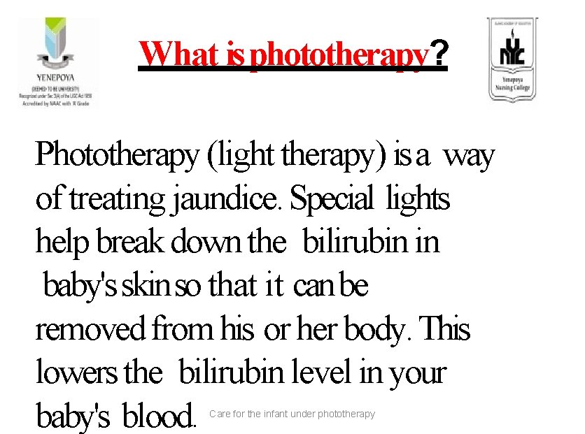 What is phototherapy? Phototherapy (light therapy) is a way of treating jaundice. Special lights