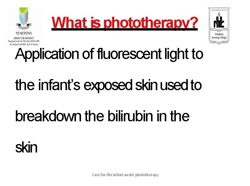 What is phototherapy? Application of fluorescent light to the infant’s exposed skin used to