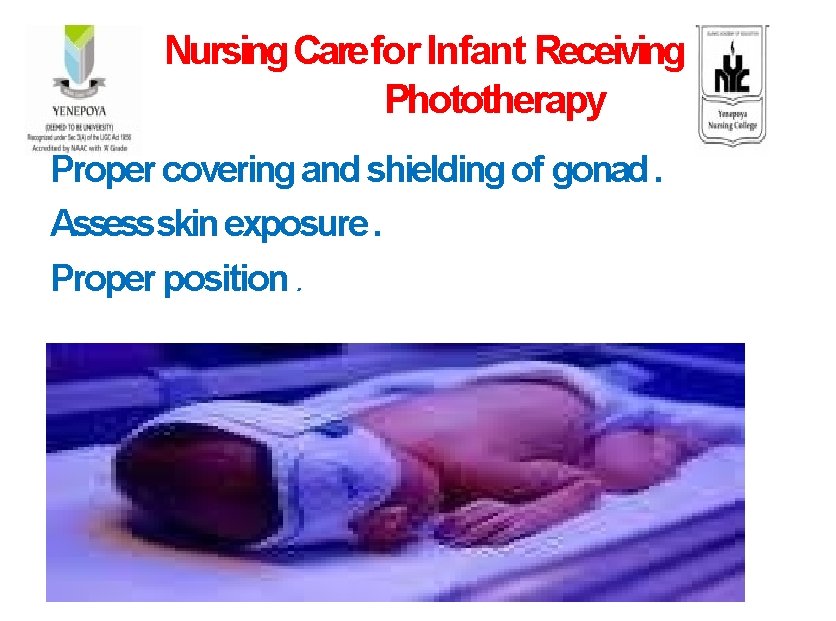 Nursing Care for Infant Receiving Phototherapy Proper covering and shielding of gonad. Assessskin exposure.