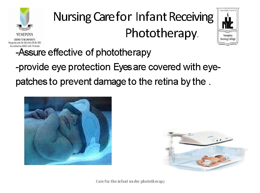 Nursing Care for Infant Receiving Phototherapy. -Assure effective of phototherapy -provide eye protection Eyes