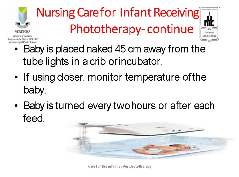 Nursing Care for Infant Receiving Phototherapy- continue • Baby is placed naked 45 cm