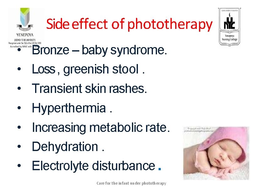 Side effect of phototherapy • • Bronze – baby syndrome. Loss , greenish stool.