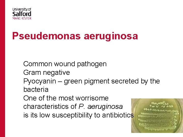 Pseudemonas aeruginosa Common wound pathogen Gram negative Pyocyanin – green pigment secreted by the