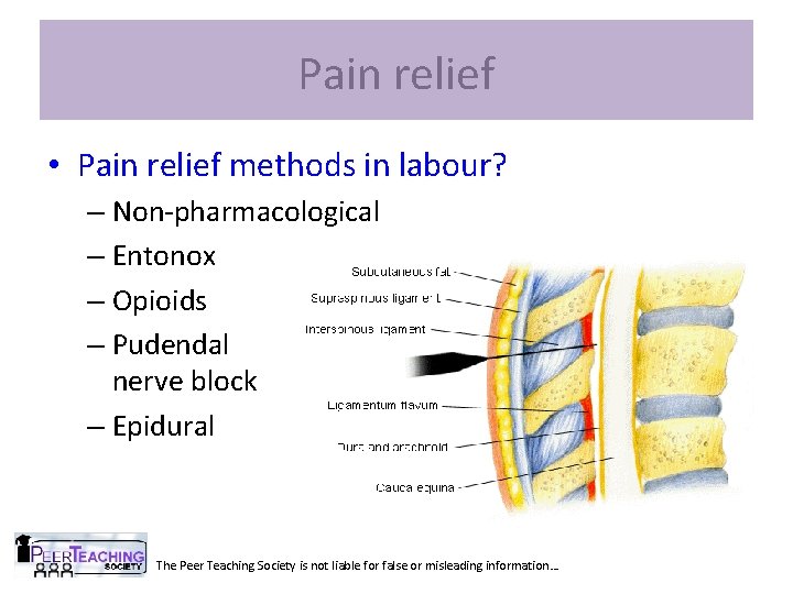 Pain relief • Pain relief methods in labour? – Non-pharmacological – Entonox – Opioids