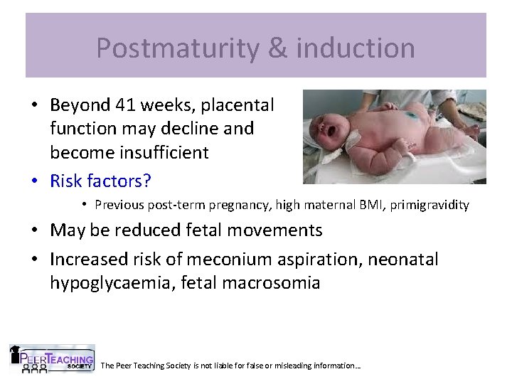 Postmaturity & induction • Beyond 41 weeks, placental function may decline and become insufficient
