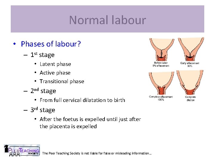 Normal labour • Phases of labour? – 1 st stage • Latent phase •