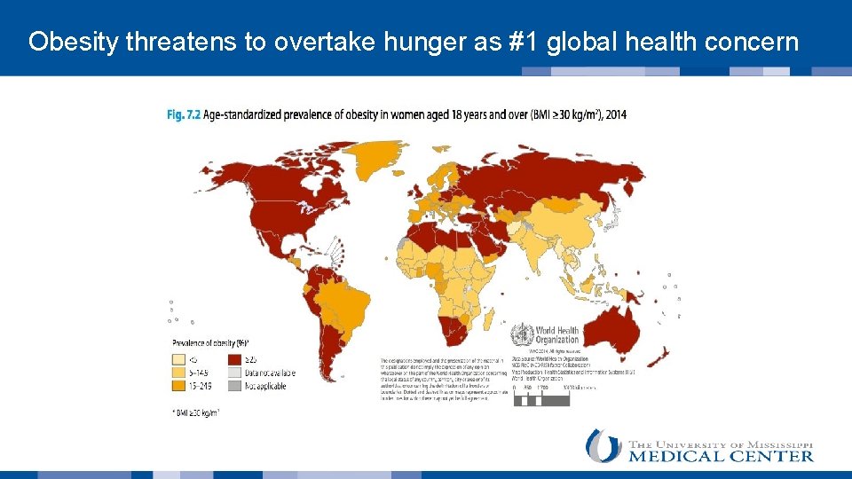  Obesity threatens to overtake hunger as #1 global health concern 