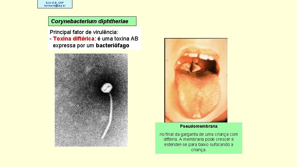 EJV-ICB_USP bevicent@usp. br Corynebacterium diphtheriae Principal fator de virulência: - Toxina diftérica: é uma