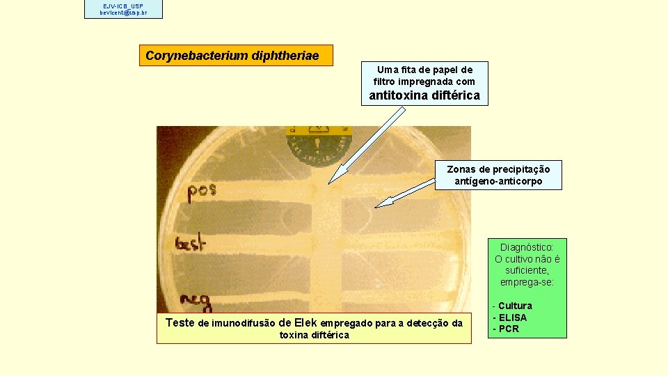 EJV-ICB_USP bevicent@usp. br Corynebacterium diphtheriae Uma fita de papel de filtro impregnada com antitoxina