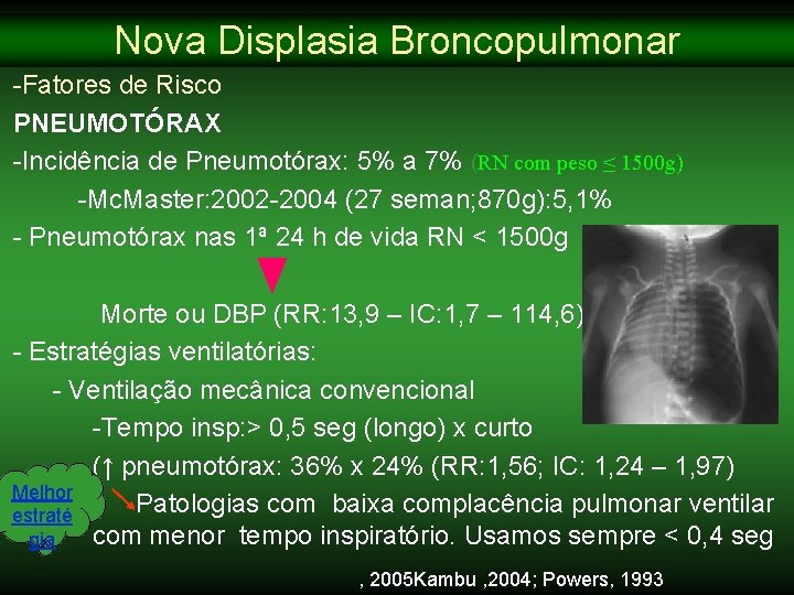Nova Displasia Broncopulmonar -Fatores de Risco PNEUMOTÓRAX -Incidência de Pneumotórax: 5% a 7% (RN