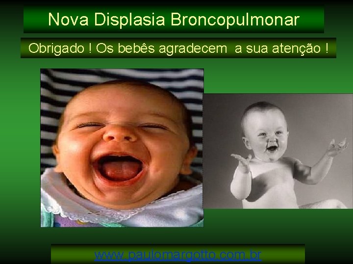 Nova Displasia Broncopulmonar Obrigado ! Os bebês agradecem a sua atenção ! www. paulomargotto.