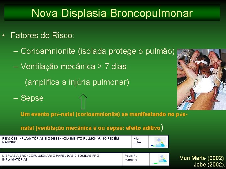 Nova Displasia Broncopulmonar • Fatores de Risco: – Corioamnionite (isolada protege o pulmão) –