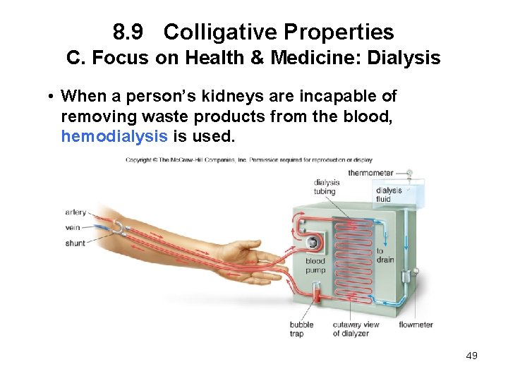 8. 9 Colligative Properties C. Focus on Health & Medicine: Dialysis • When a