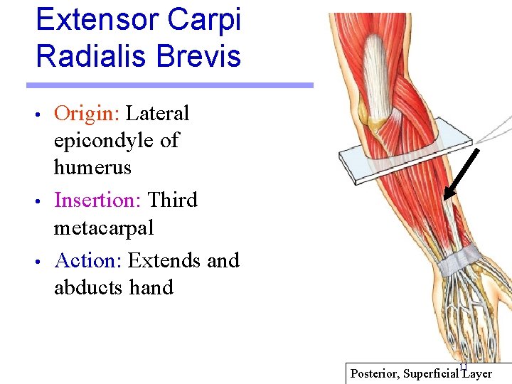 Extensor Carpi Radialis Brevis • • • Origin: Lateral epicondyle of humerus Insertion: Third Extensor Carpi Radialis Brevis • • • Origin: Lateral epicondyle of humerus Insertion: Third