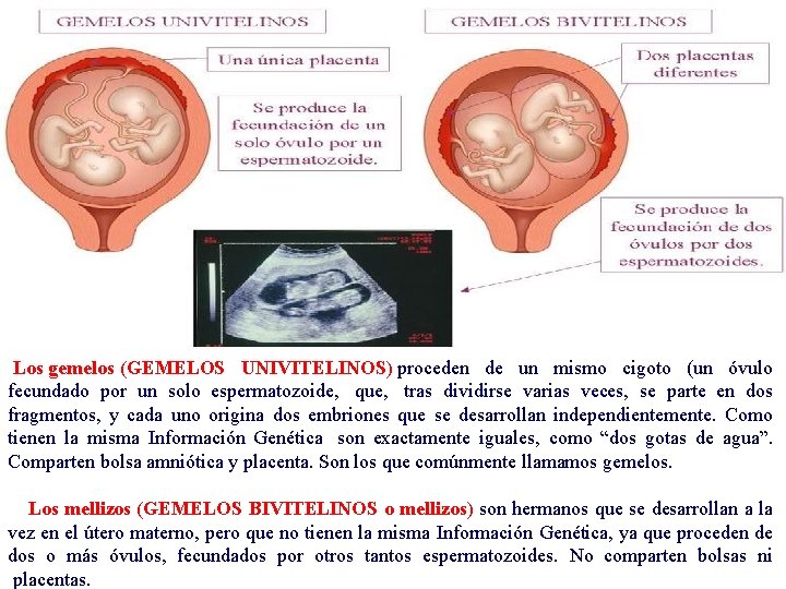  Los gemelos (GEMELOS UNIVITELINOS) proceden de un mismo cigoto (un óvulo fecundado por