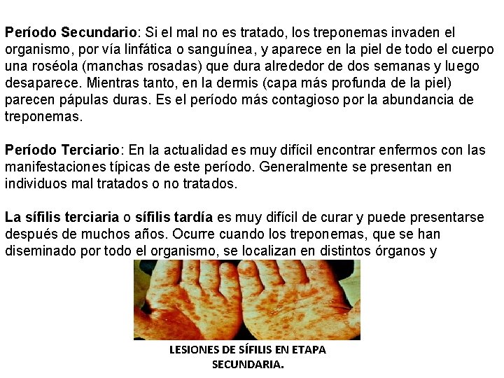 Período Secundario: Si el mal no es tratado, los treponemas invaden el organismo, por
