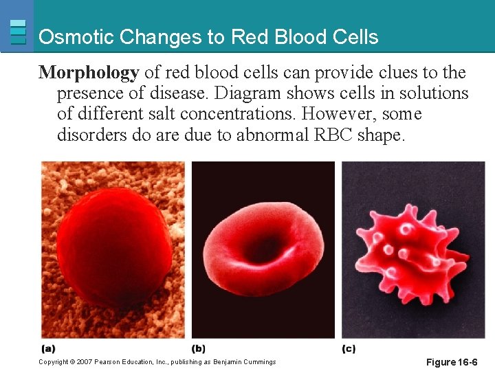 Osmotic Changes to Red Blood Cells Morphology of red blood cells can provide clues