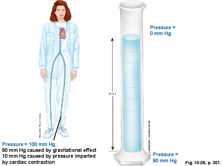 Pressure = 0 mm Hg Pressure = 100 mm Hg 90 mm Hg caused Pressure = 0 mm Hg Pressure = 100 mm Hg 90 mm Hg caused