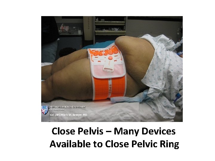 Col (ret) Mark W. Bowyer MD Close Pelvis – Many Devices Available to Close