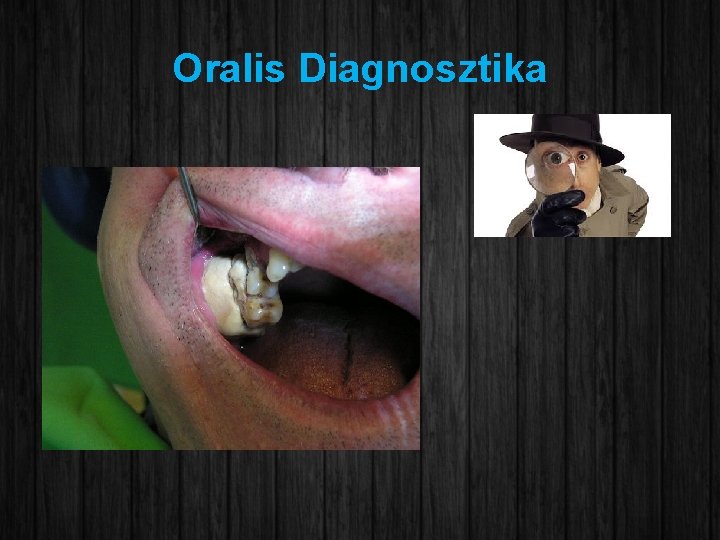 Oralis Diagnosztika 