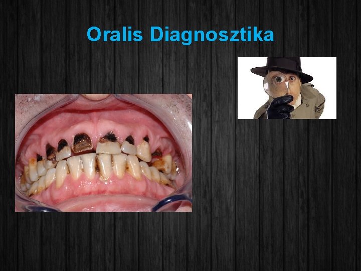 Oralis Diagnosztika 