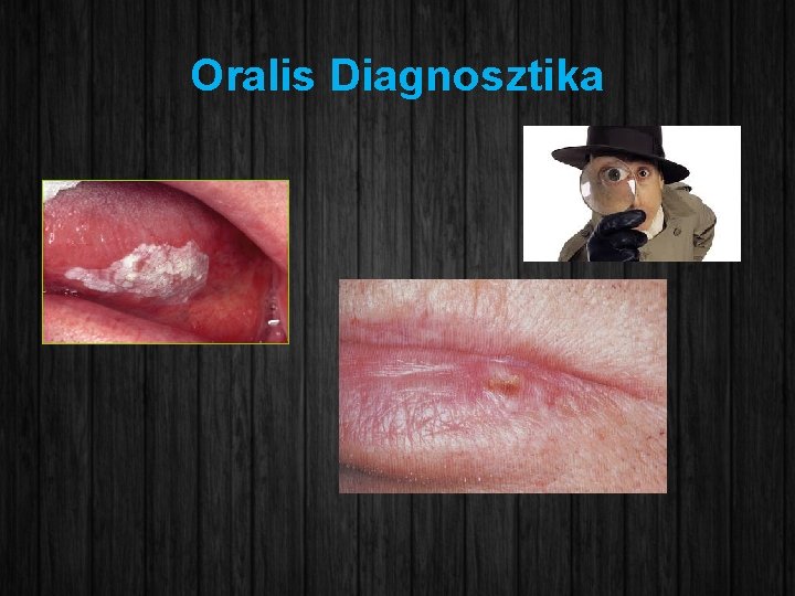 Oralis Diagnosztika 