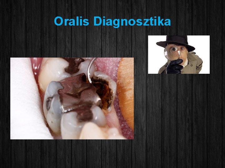 Oralis Diagnosztika 