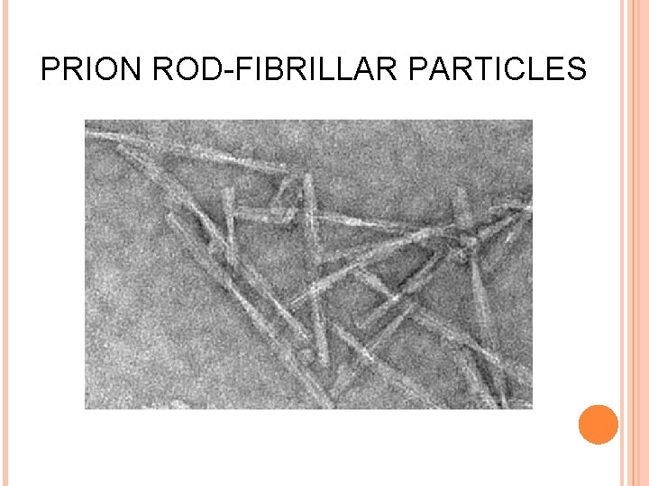 PRION ROD-FIBRILLAR PARTICLES 